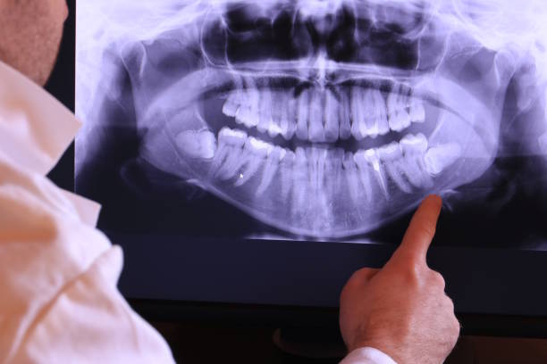 Best Emergency Treatment for Oral Infections in Edgecliff Village, TX